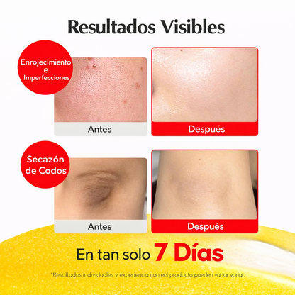 EQQUALBERRY Suero iluminador